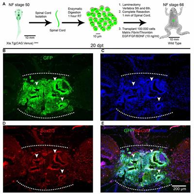 Spinal Cord Cells from Pre-metamorphic Stages Differentiate into Neurons and Promote Axon Growth and Regeneration after Transplantation into the Injured Spinal Cord of Non-regenerative Xenopus laevis Froglets